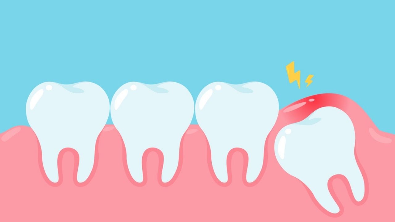 Identifique a sua dor de dente