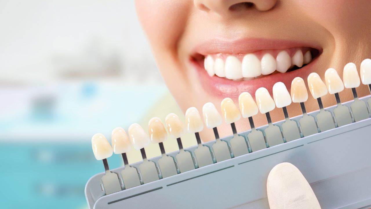 implante dentário antes e depois