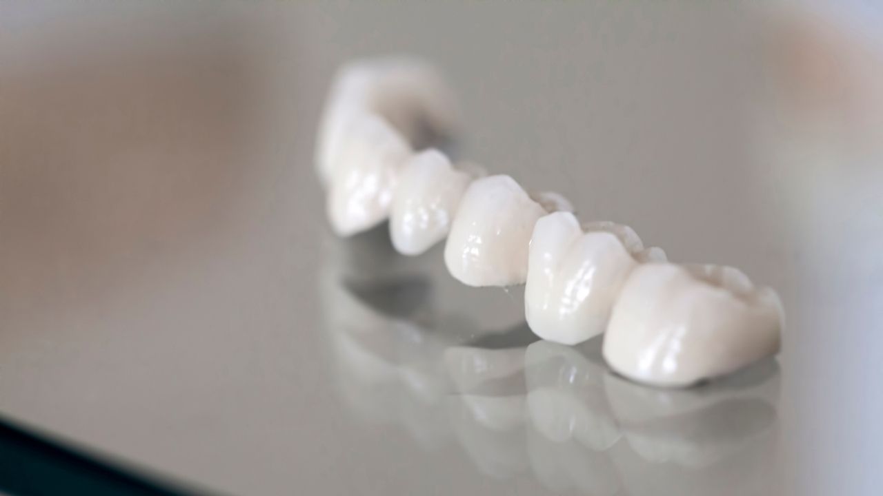 dente de porcelana